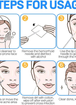 Stainless Steel Acne-Blackhead Removal Stick Tool